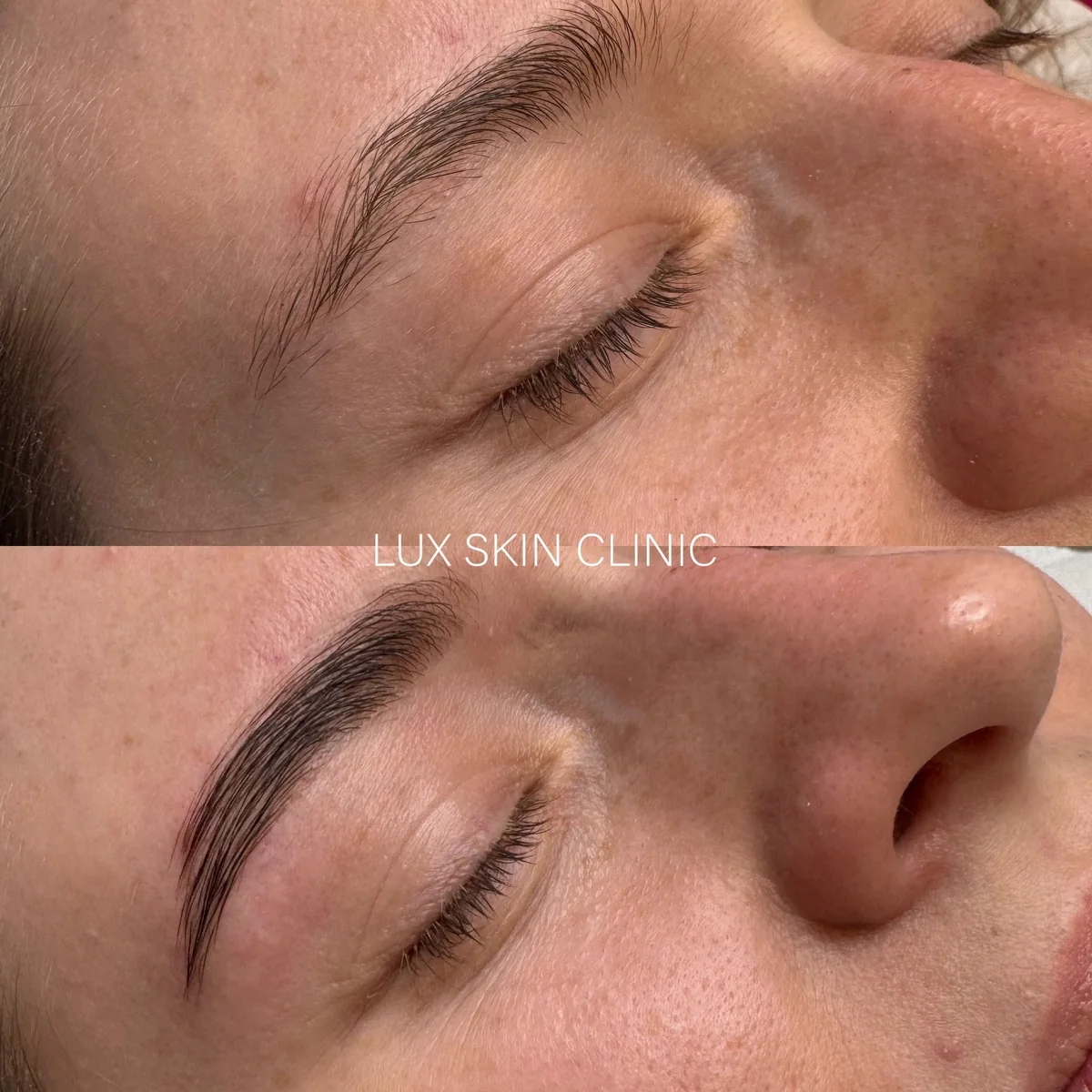 Efekt stylizacji brwi w Lux Skin Clinic — zdjęcie 5