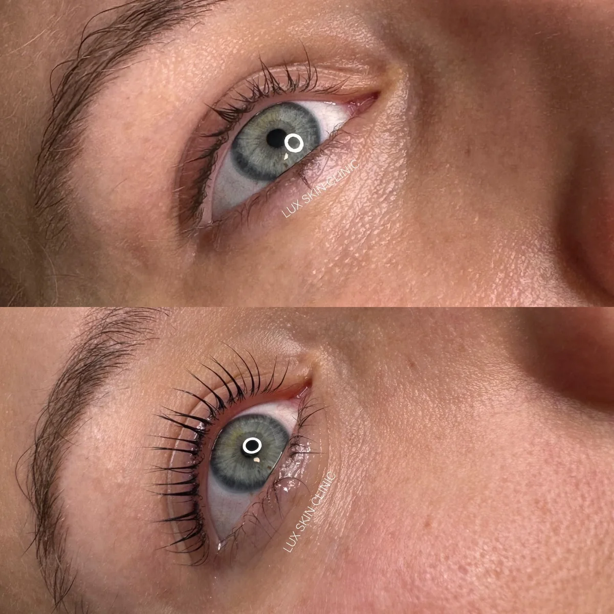 Lifting rzęs w Lux Skin Clinic
