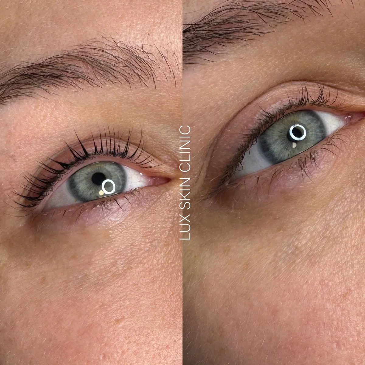 Lifting rzęs w Lux Skin Clinic
